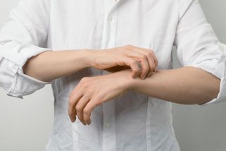 Svědící pupínky mezi prsty? Možná jste si z dovolené přivezli svrab